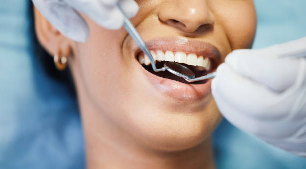 Best Emergency Dental Care for Sports Injuries in Franklinton, NC