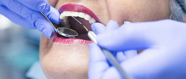Best Dental Abscess Treatment in Franklinton, NC
